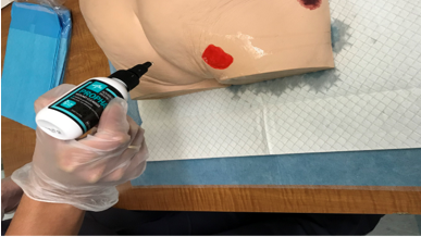 A photo of a nurse practicing using a would cleanser for a pressure injury 